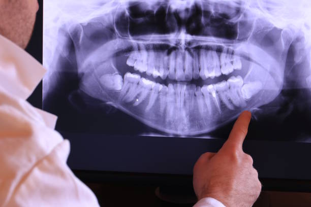 Best Emergency Dentist Near Me  in Columbia Heights, MN